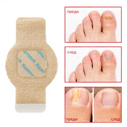 Elaimei™  Fungal Nail Patches